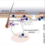 Non-classical Immunity Controls Microbiota Impact on Skin Immunity and Tissue Repair